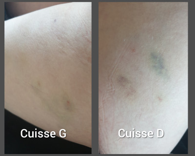 Voila ce que donne les bleu lol