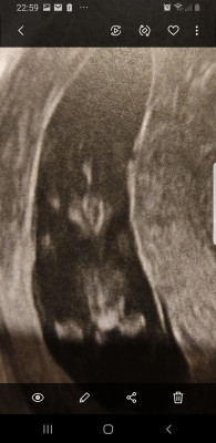 Photo voie abdominale