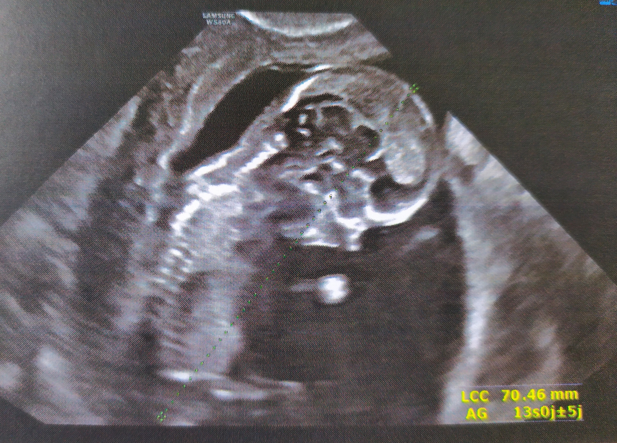 Un Bebe Pour Octobre 21 Page 109 Le Forum De La Fiv Insemination Et De La Pma